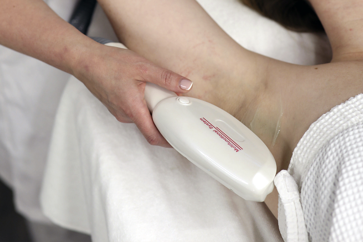 IPL Karvanpoisto Turvallinen ja Tehokas Karvanpoisto Valohoidolla