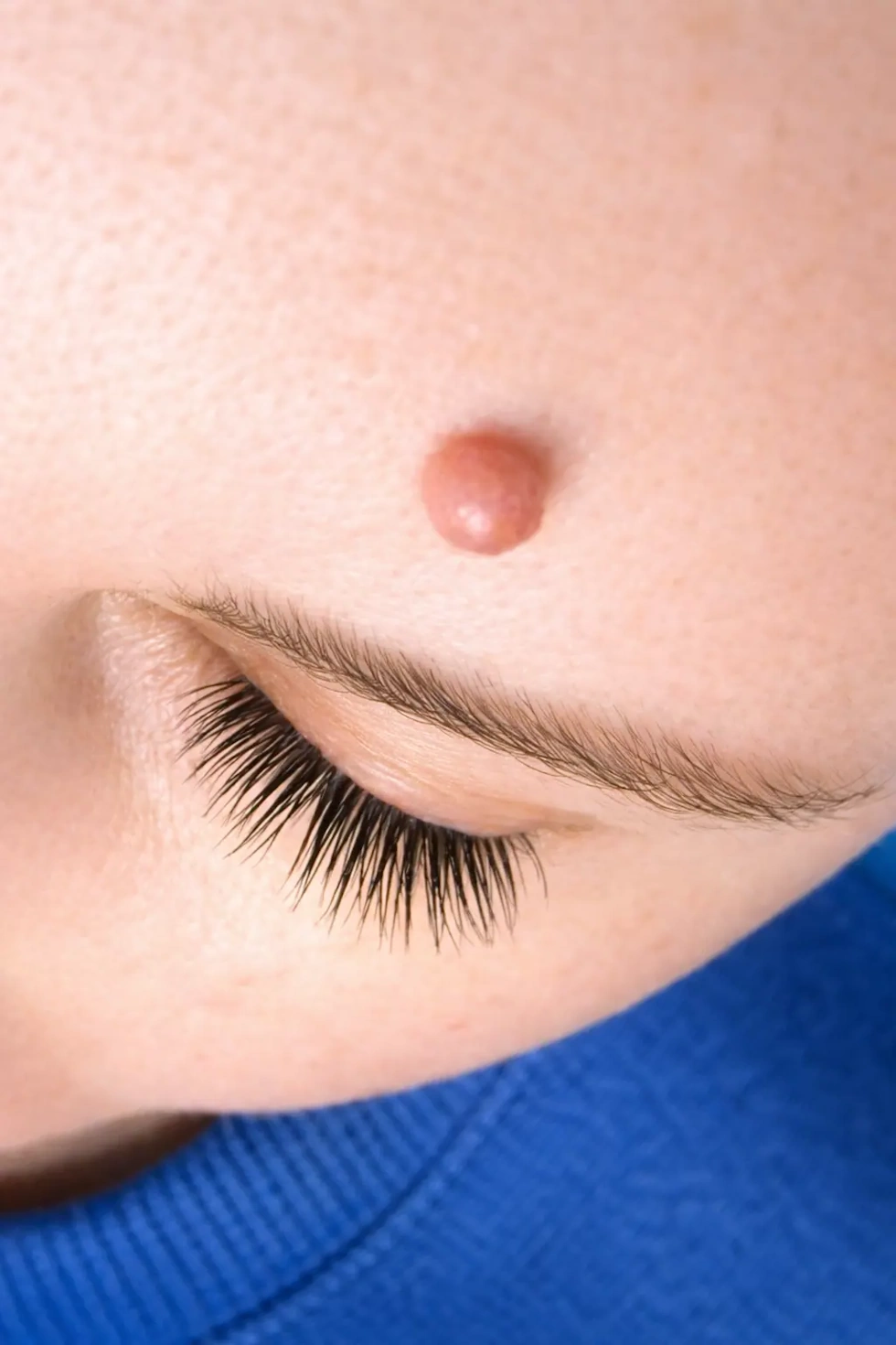 Luomen poistopalvelut kauneushoitolassamme Katajanokalla